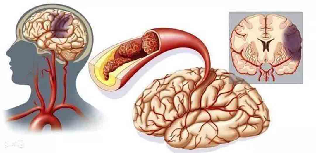 jingdongmaibankuai.jpg jingdongmaibankuai.jpg